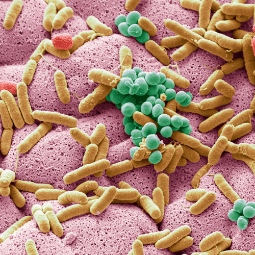 bacterial infection on face