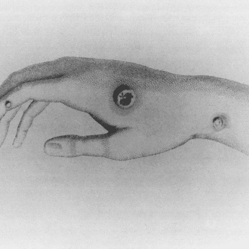 cowpox in infants cowpox in infants